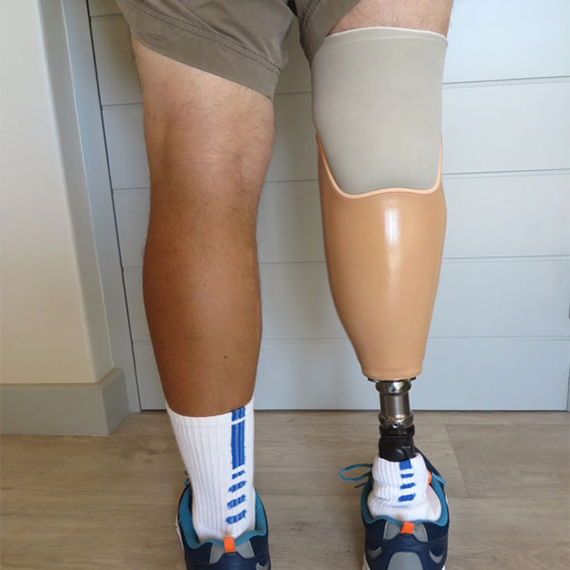 3D Printed Leg